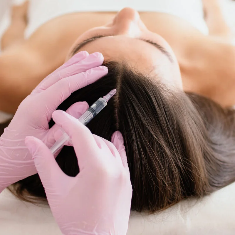 Capillary Treatment with PRP