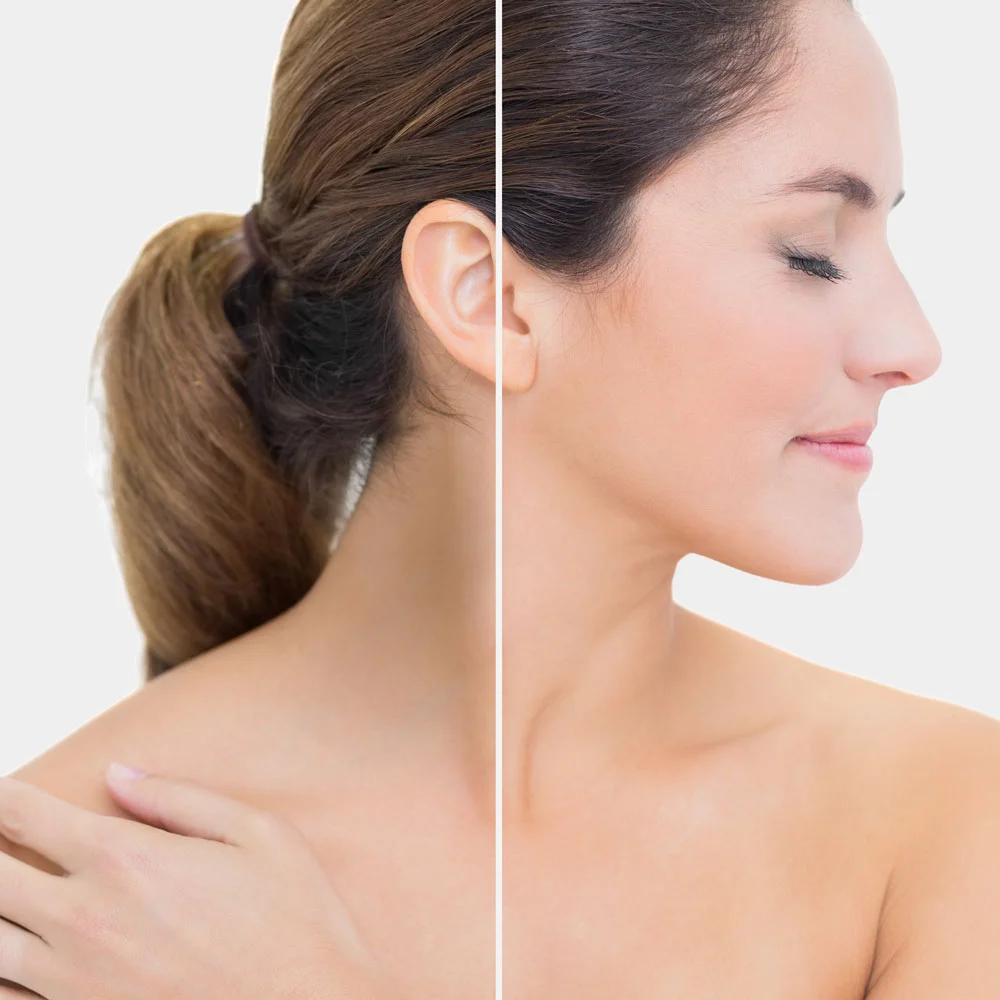 Neck Lightening