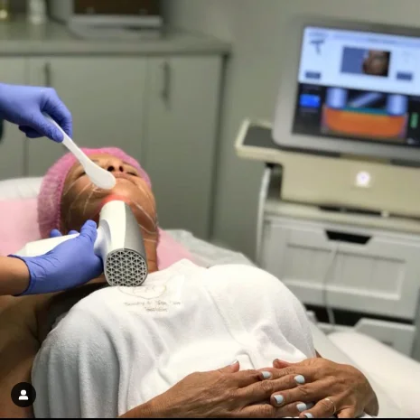 Skin Tightening Treatment