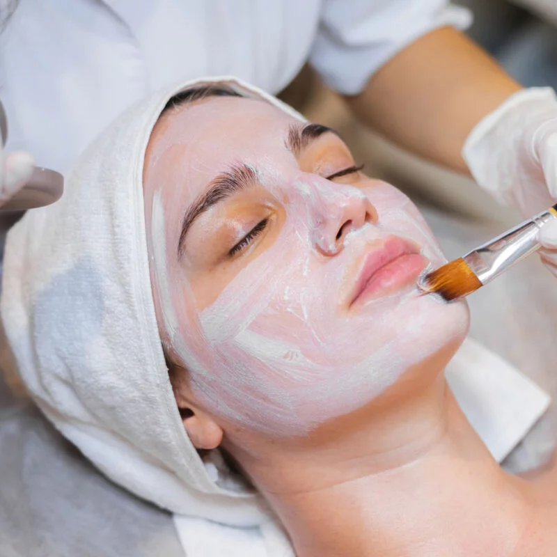 Chemical Peels