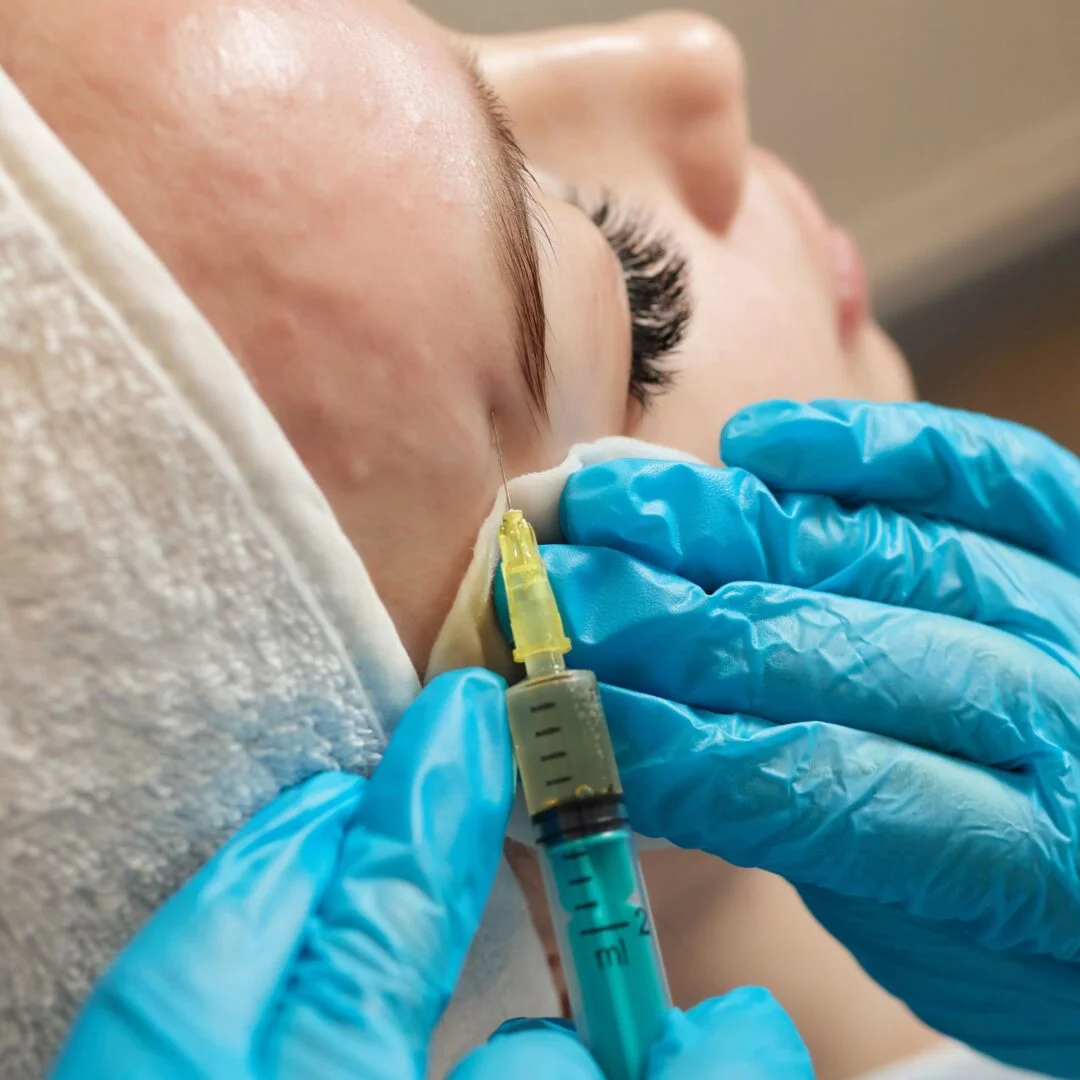 Under Eye Treatment with PRP