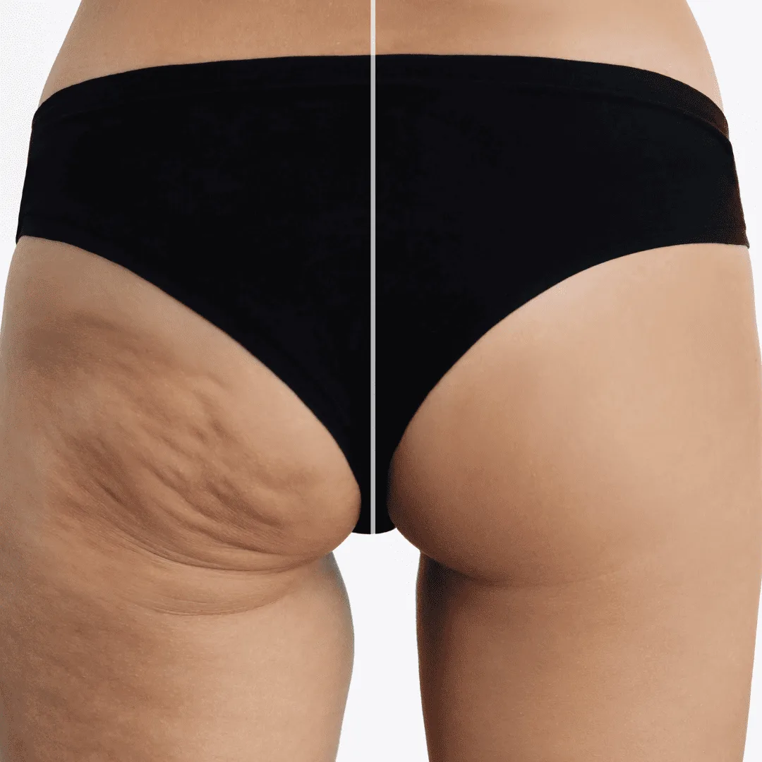 Semaglutide + Lipotropics Packages