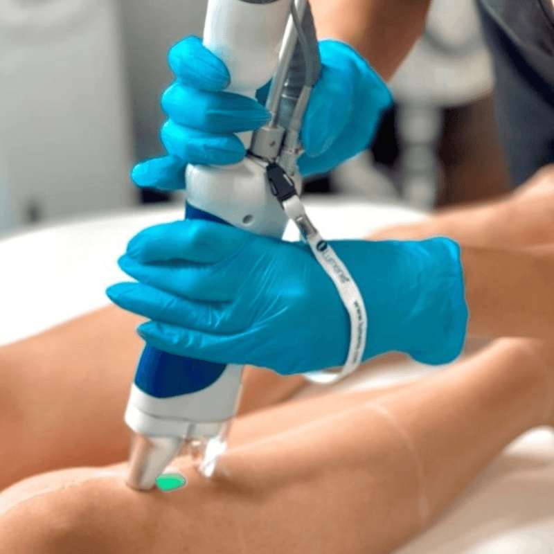 Laser Hair Removal buy one get 1 free area